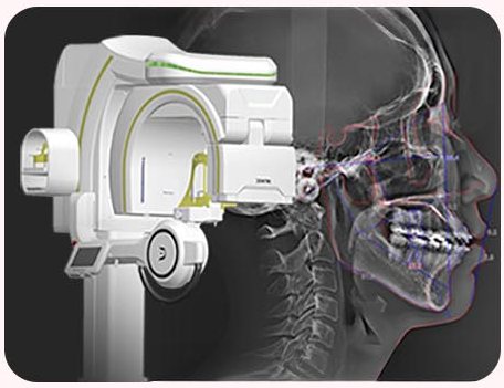 3D CT 장비와 측면 CT 영상