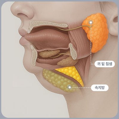 두꺼비목성형 3단계 — 귀 밑 침샘·속지방 표시 해부도