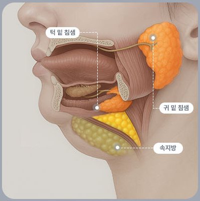 두꺼비목성형 4단계 — 턱 밑 침샘·귀 밑 침샘·속지방 표시 해부도