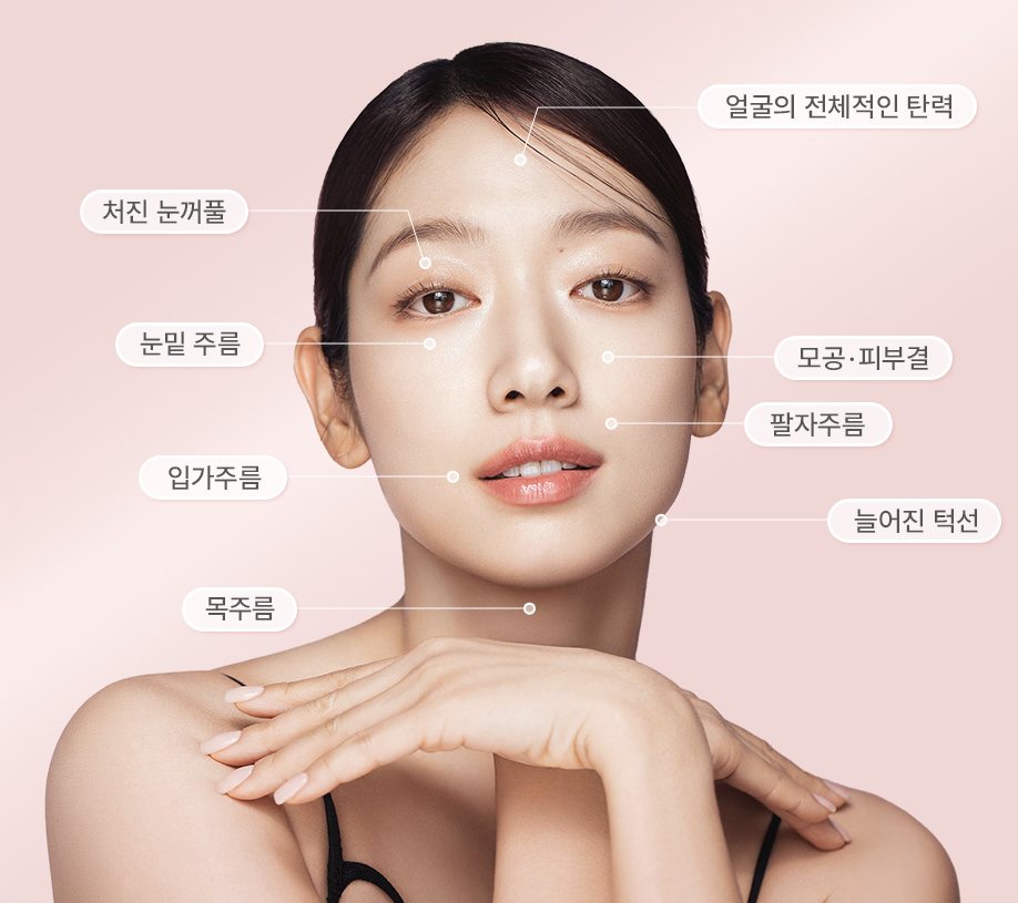 시술 부위 표시 모델 사진(부위 이름표가 사진에 포함)