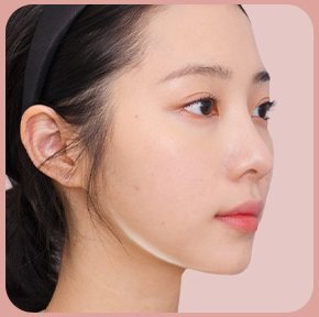 STEP 04 — 슬림한 턱라인 완성 옆모습