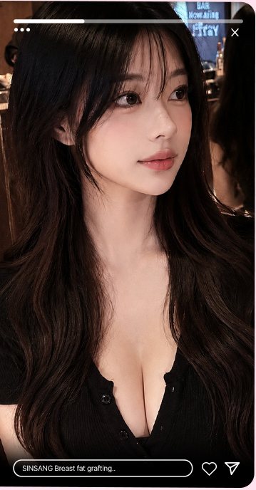 인플루언서 스토리 화면 1(SINSANG Breast fat grafting)