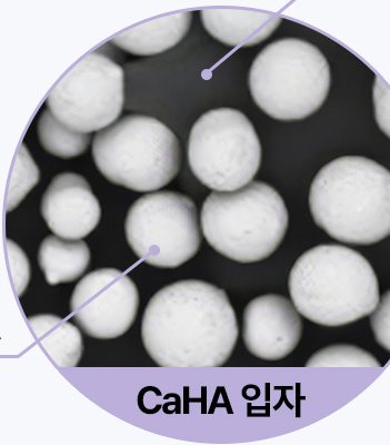 CaHA 입자 현미경 이미지(원 안 아래에 'CaHA 입자' 라벨)
