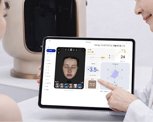 태블릿으로 AI 피부진단 결과를 설명하는 장면(뒤에 피부분석 장비)