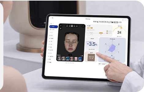 AI 피부진단 결과가 표시된 태블릿