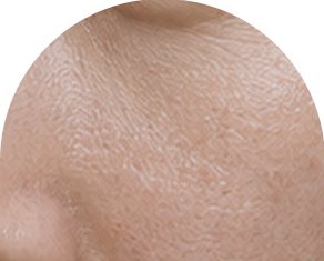 모공과 결이 드러난 코 옆 피부