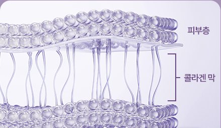 시술 전 늘어진 콜라겐 막 단면
