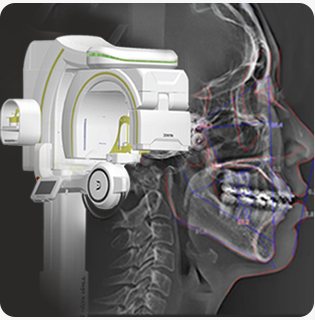 3D-CT 장비와 CT 영상