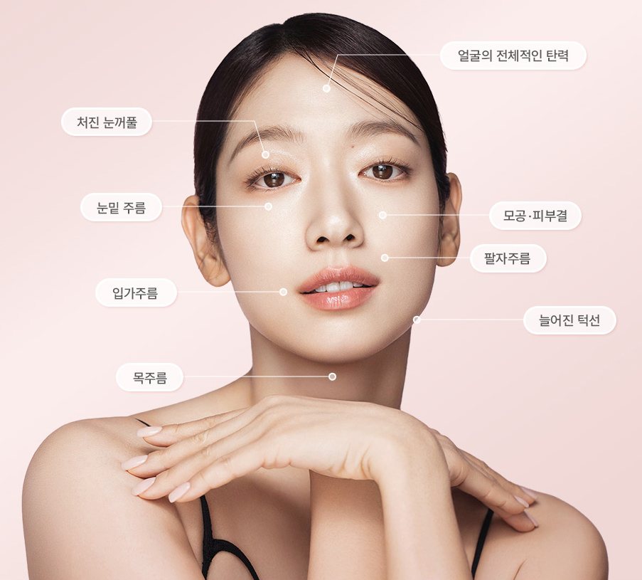 모델 얼굴 위 세르프 시술 부위 표시