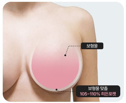 보형물 맞춤 105~110% 히든포켓 도식