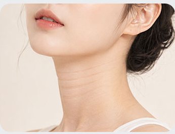가로 목주름이 보이는 여성 목선