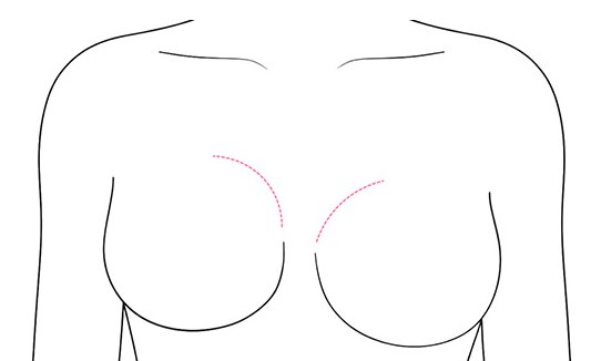 구형구축 의심 가슴 선 일러스트