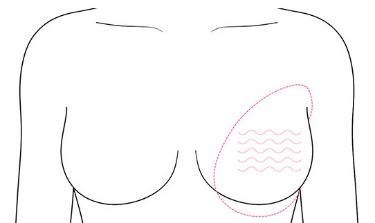 모양·촉감 불만족 가슴 선 일러스트