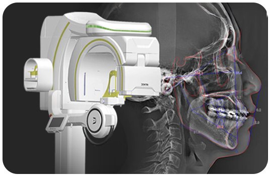 3D CT 장비와 두개골 측면 영상