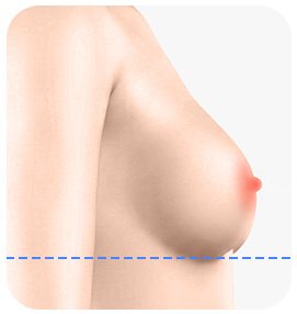 유방 하수 정상 측면 일러스트