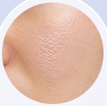 모공이 보이는 볼 피부