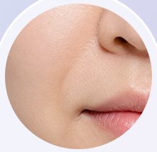 팔자주름 부위