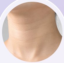 목주름 부위