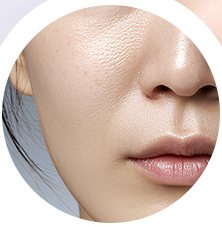 주름이 있는 코옆 피부