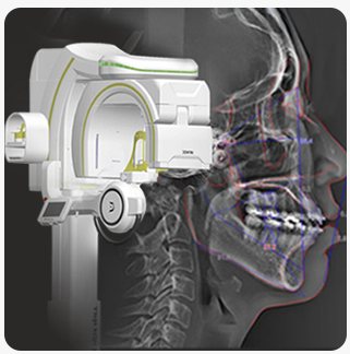 3D-CT 장비