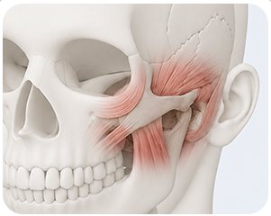연부조직 상방 고정 방향 일러스트