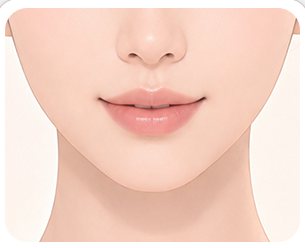 섬세한 봉합 후 턱끝 라인 일러스트