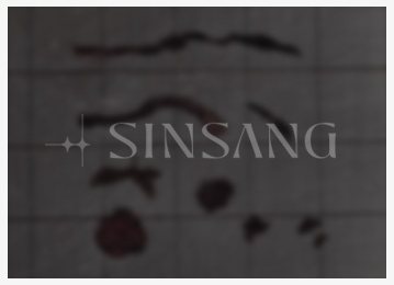 제거한 이물질 케이스 15