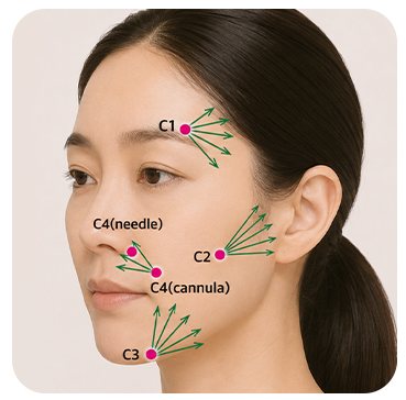 C 코드 주입 포인트(C1~C4) 얼굴 도식