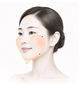 하트라인 윤곽이 표시된 모델