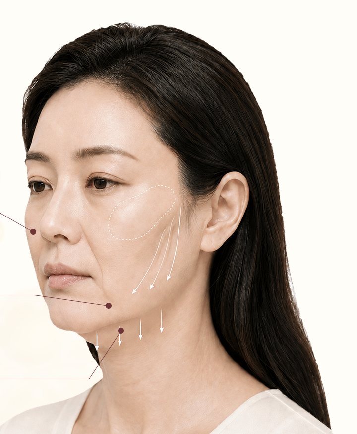 볼륨·처짐 부위 표시된 중년 여성 모델
