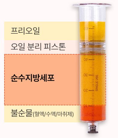 리포킷 주사기 층 분리 도식(프리오일·오일 분리 피스톤·순수지방세포·불순물)