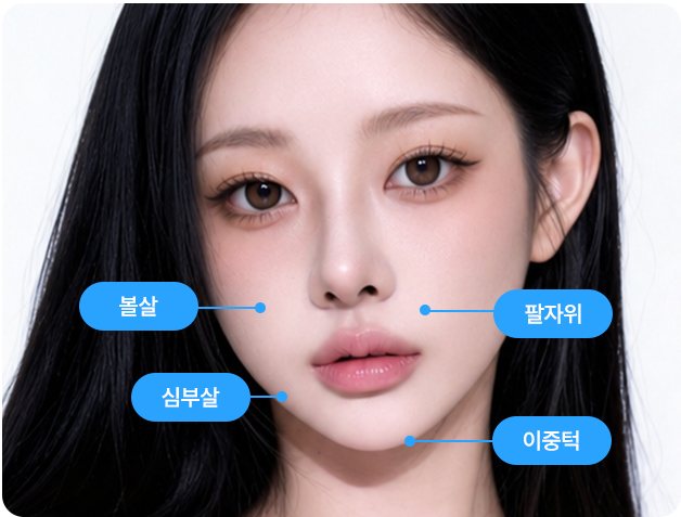 얼굴 지방흡입 부위 표시(볼살·팔자위·심부살·이중턱)
