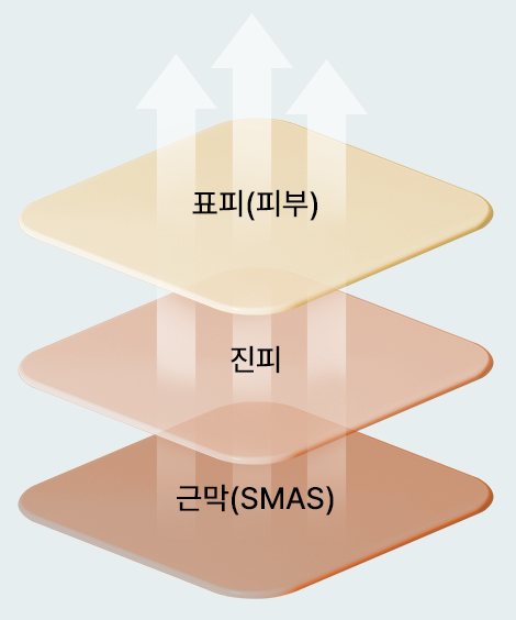 표피(피부)·진피·근막(SMAS) 층을 함께 끌어올리는 도식