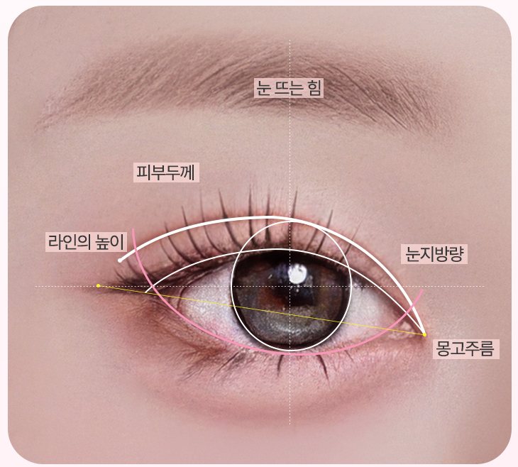 눈 분석 도식 — 눈 뜨는 힘·피부두께·라인의 높이·눈지방량·몽고주름