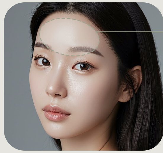 여성 모델 얼굴, 이마와 눈 위 신경선 영역 점선 표시