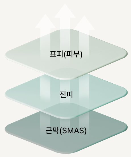 표피(피부)·진피·근막(SMAS) 3단 리프팅 도식