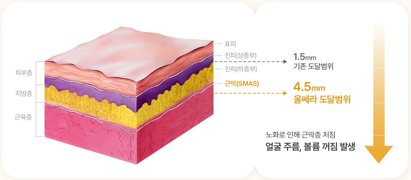 피부 층 구조와 기존 1.5mm·울쎄라 4.5mm 도달범위 도식